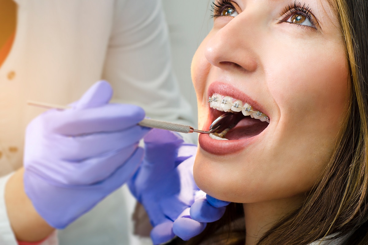 Phase 1 vs phase 2 orthodontics timing benefits and outcomes blog